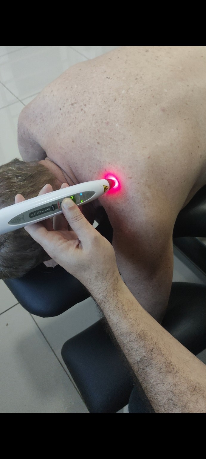 Aplicação de laser terapêutico na região entre o pescoço e o ombro durante um atendimento no consultório.